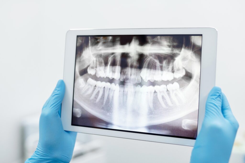 Are adults eligible for NHS orthodontic treatment? Dr Kiarash Banai
